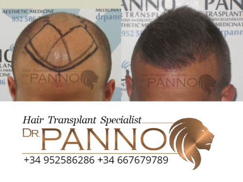 www.drpanno.com